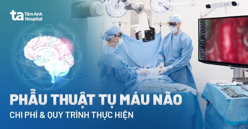 phẫu thuật tụ máu não