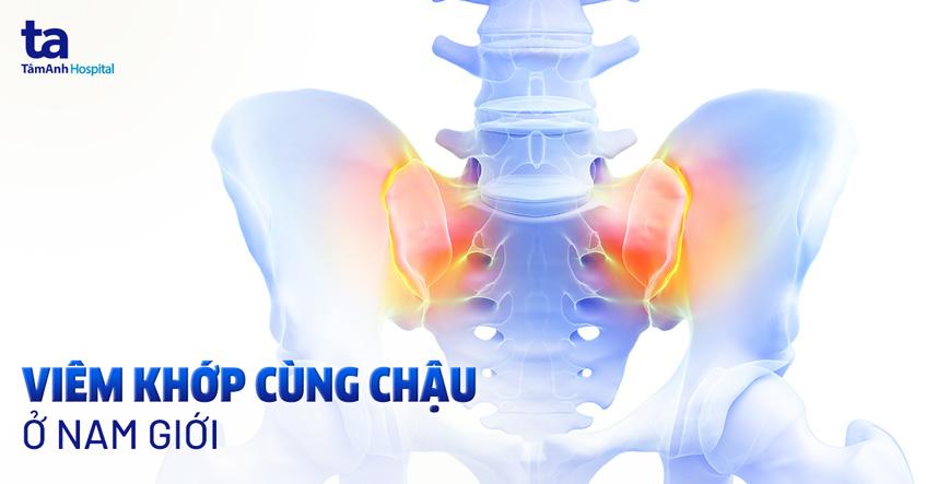 viêm khớp cùng chậu ở nam giới