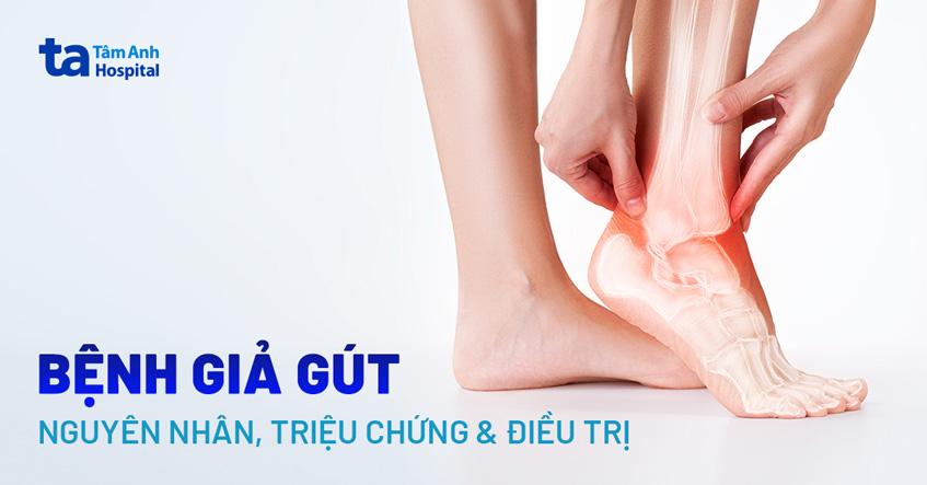 bệnh giả gout