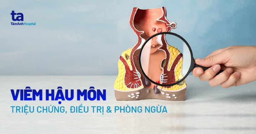 bị viêm hậu môn