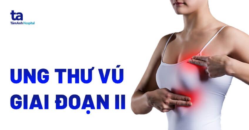 ung thư vú giai đoạn 2