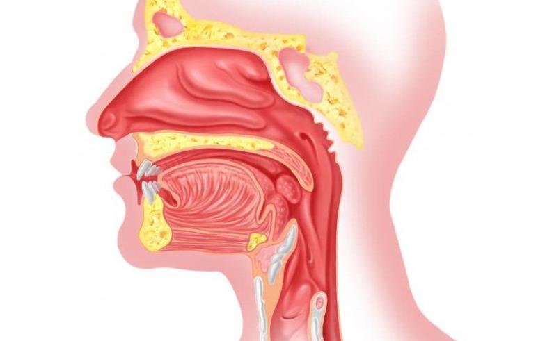 Bệnh Tai Mũi Họng có thể gặp ở cả người lớn và trẻ nhỏ