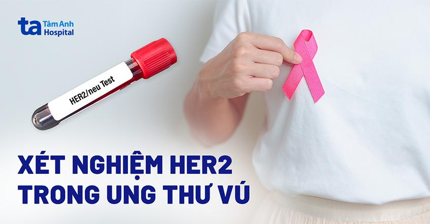 Xét nghiệm HER2